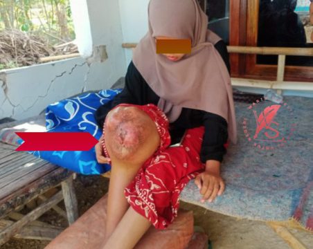 IMG 20240710 WA0007 768x576 1 Kesehatan